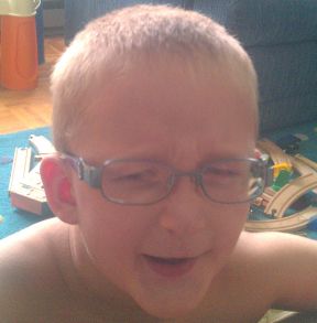 boy wearing glasses for iris coloboma