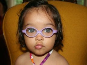 toddler girl in glasses for farsightedness esotropia and astigmatism
