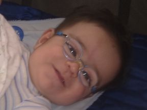 baby boy wearing glasses for cataracts