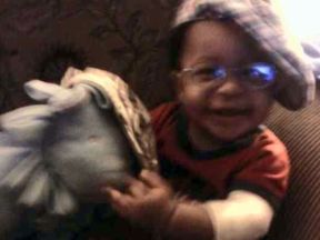 baby boy in glasses for glaucoma