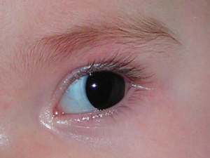 close up of the lens on Mia's eye