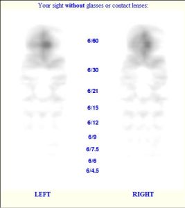 simulation of what Zoe might see without her glasses, using +4 and +4.25 as the prescription.  From www.billauer.co.il/simulator.html