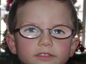 picture of a farsighted boy with glasses - prescription +9 and +10