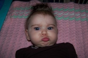 baby girl with crossed eyes, strabismus, esotropia